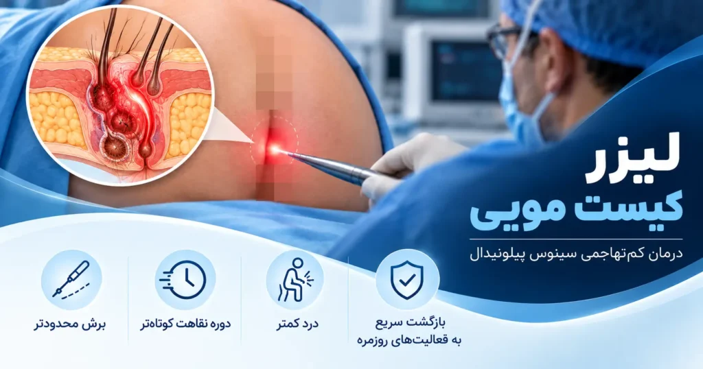 لیزر کیست مویی در اهواز - دکتر نوید سلیمی