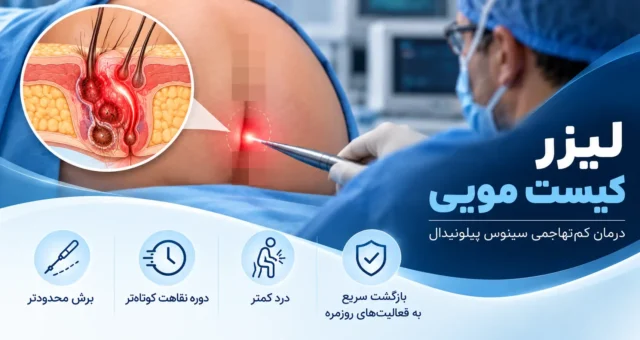 لیزر کیست مویی در اهواز - دکتر نوید سلیمی